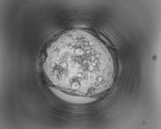 X0000116310359201001111143