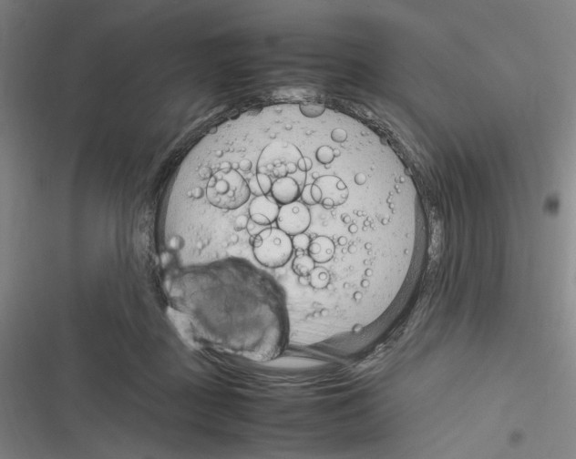 X0000116310363201001111143