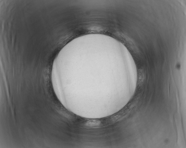 X0000116310369201001111143