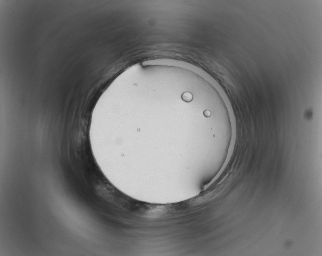 X0000116310382201001111143