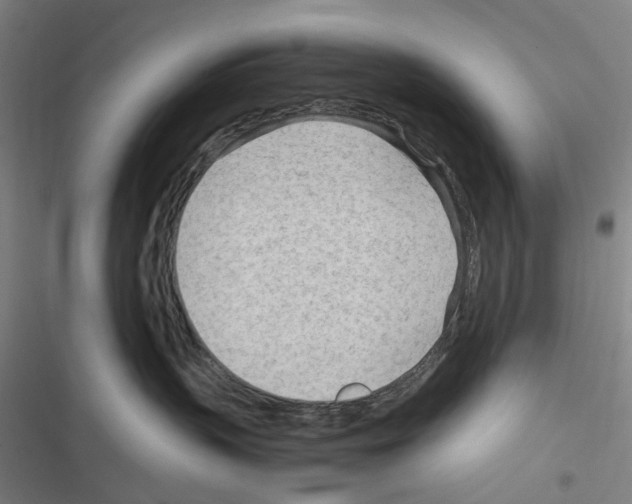 X0000116310383201001111143