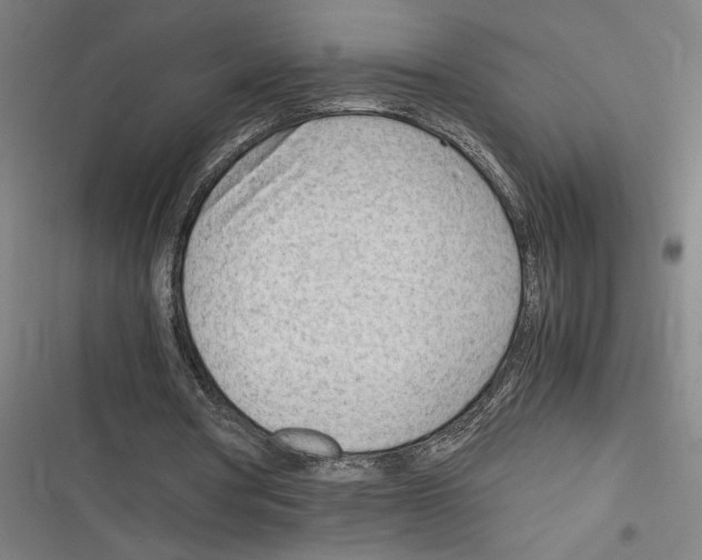 X0000116310386201001111143