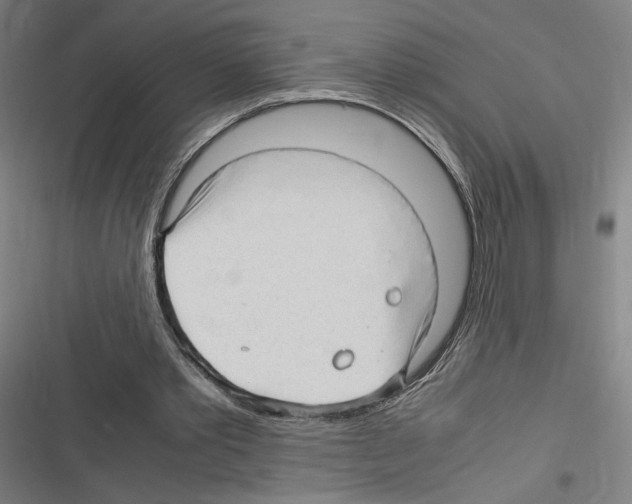 X0000116310389201001111143