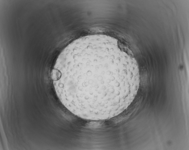 X0000116310418201001111142