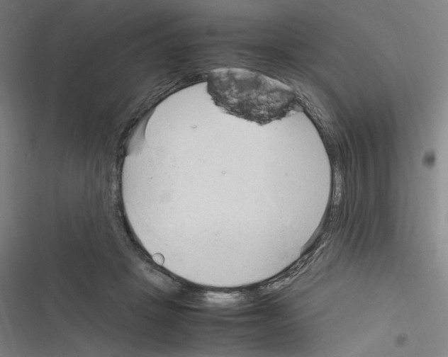 X0000116310457201001111142