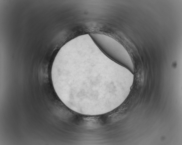 X0000116310516201001111141