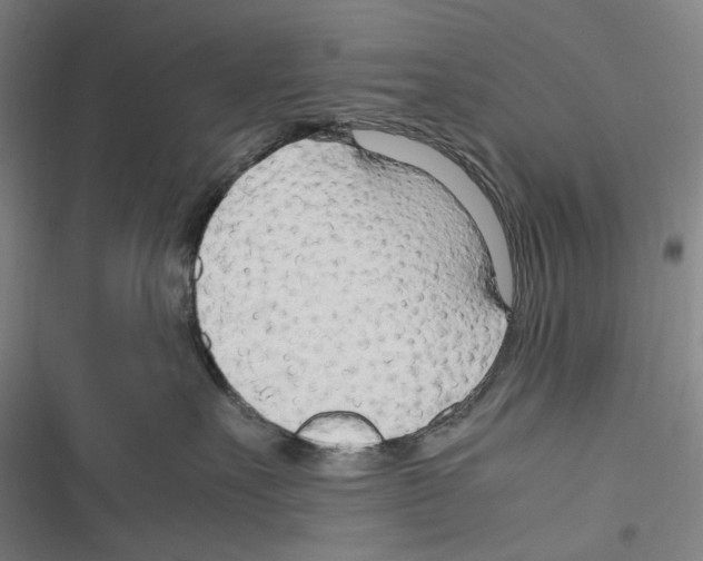 X0000116310527201001111141