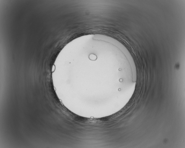 X0000116310617201001111140