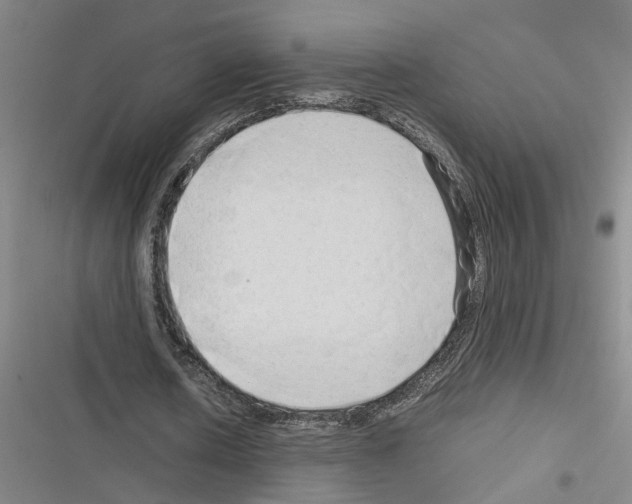 X0000116310626201001111139