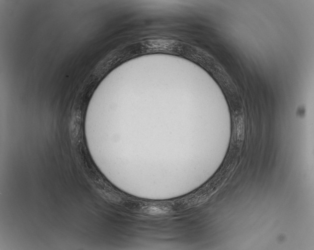 X0000116310737201001111138