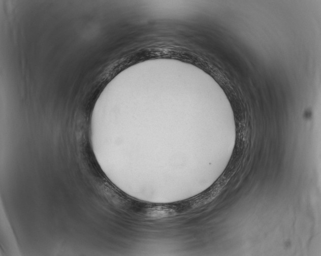 X0000116310754201001111138