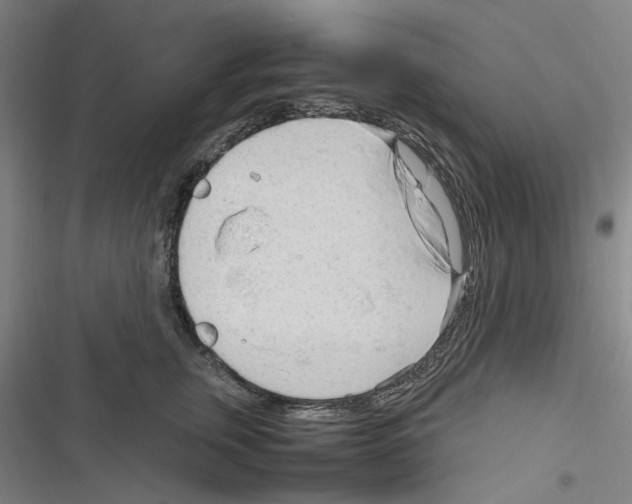 X0000116310759201001111138