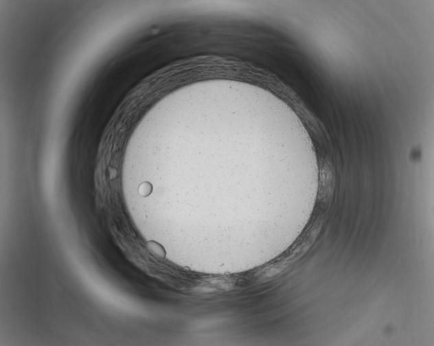 X0000116310765201001111138