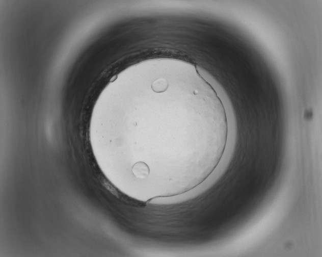 X0000116310766201001111138