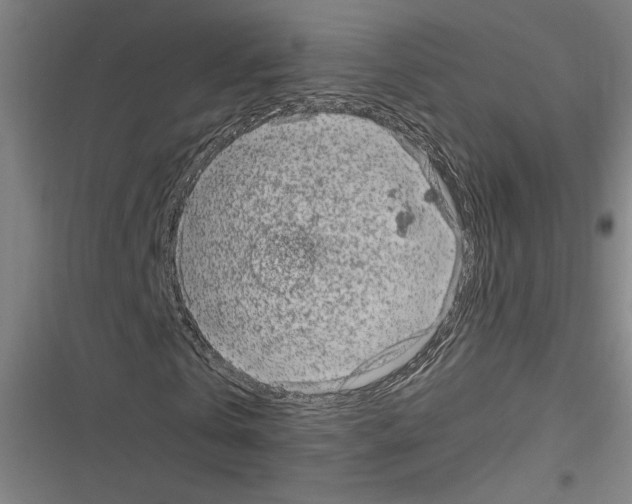 X0000116310769201001111137