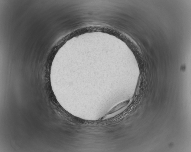 X0000116310775201001111137