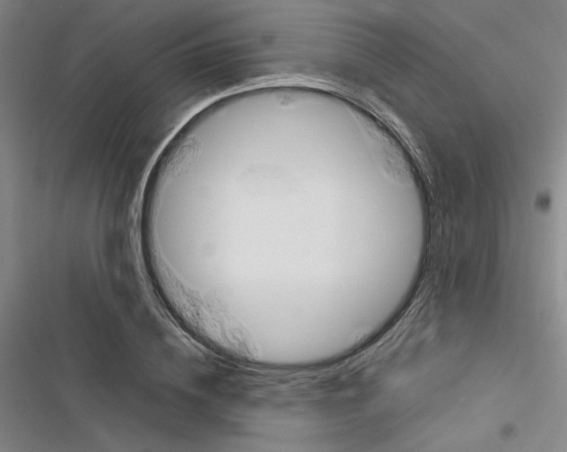 X0000116310836201001111136