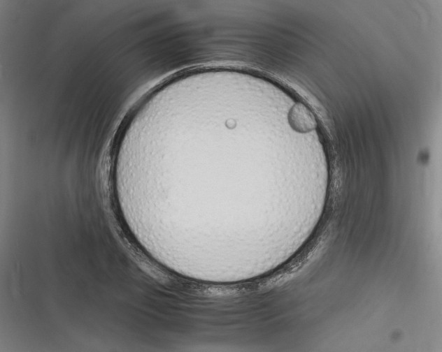 X0000116310933201001111135