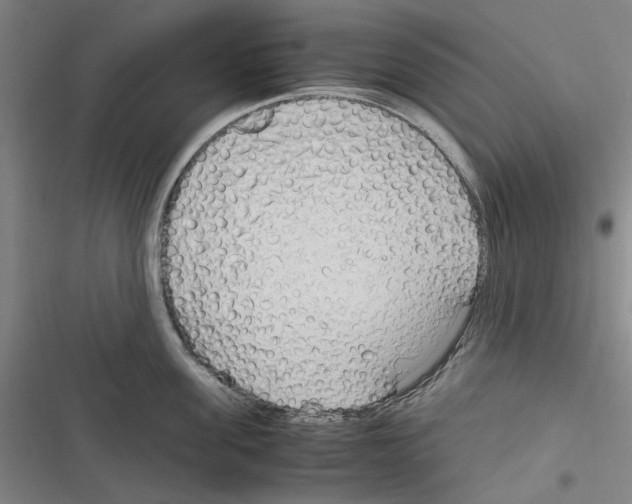 X0000116310955201001111135