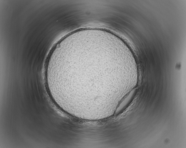 X0000116310990201001111134