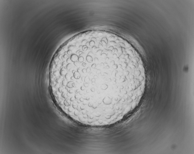 X0000116311036201001111134