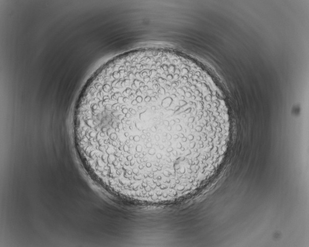 X0000116311038201001111134