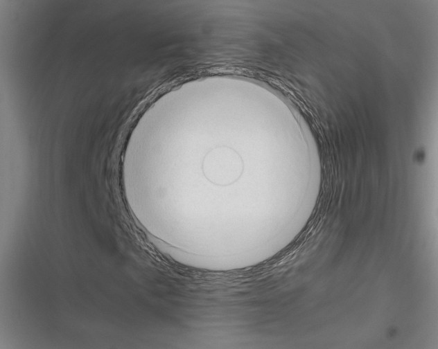 X0000116311057201001111134