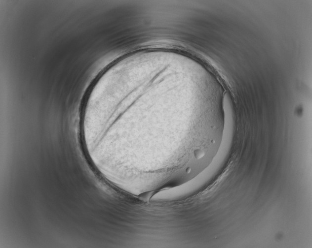 X0000116311418201001111129