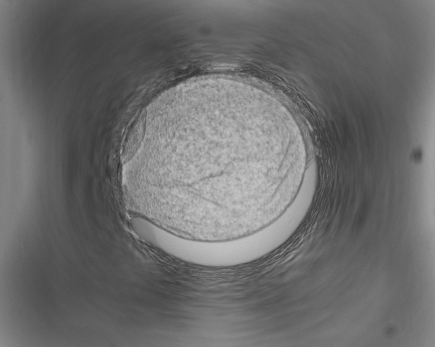 X0000116311441201001111128