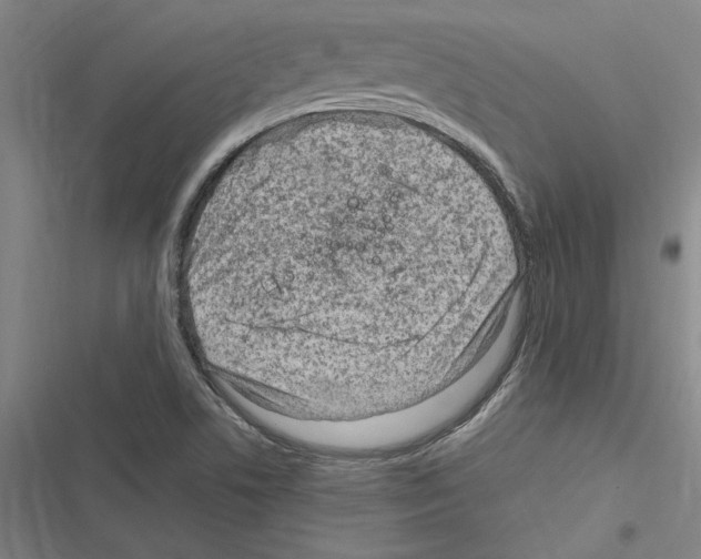 X0000116311506201001111127