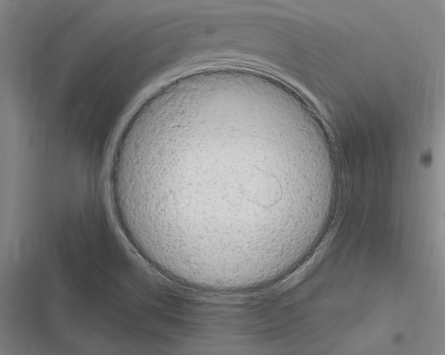 X0000116311514201001111127