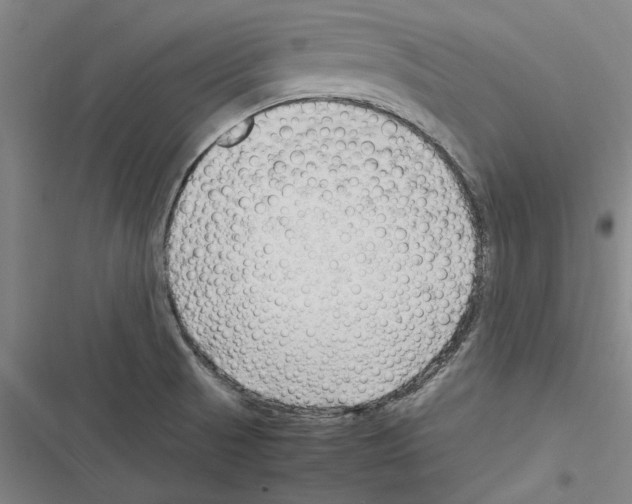 X0000116311521201001111127