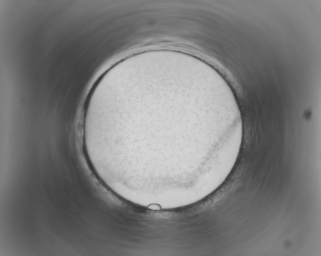 X0000116311522201001111128