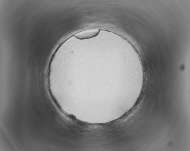 X0000116311525201001111128