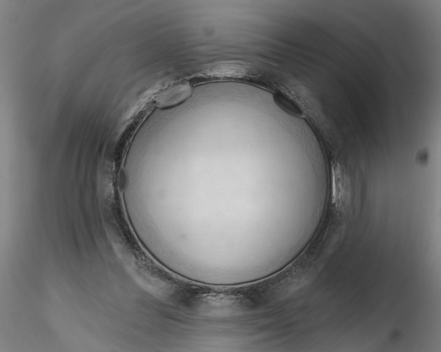 X0000116320300200912221404