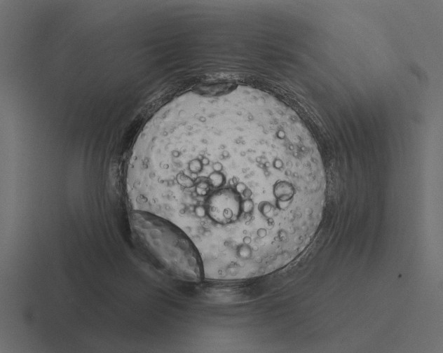 X0000116320171200912291540