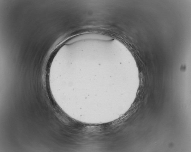 X0000116320150201001131010