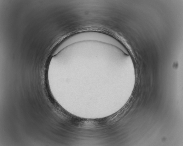 X0000116320154201001131011