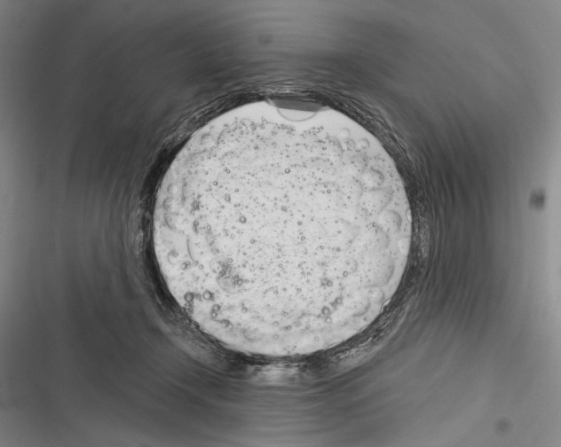 X0000116320366201001131008