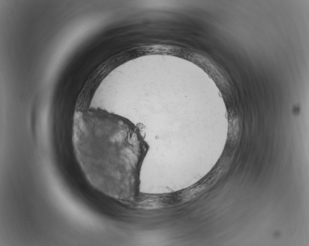 X0000116320381201001131008