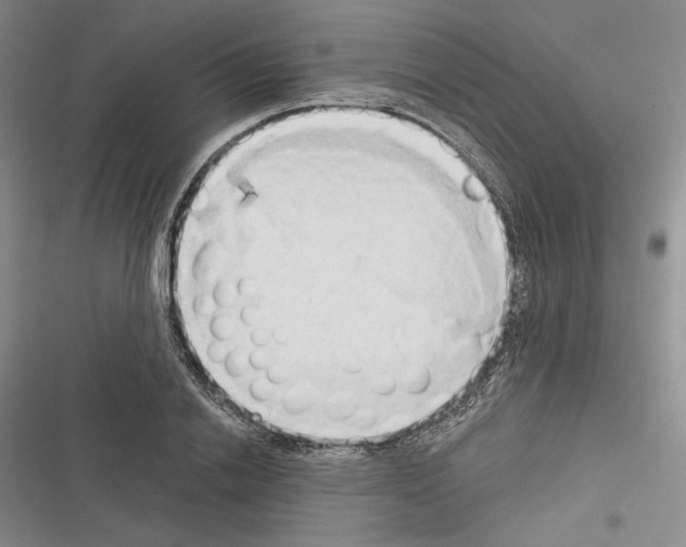 X0000116320838201001131002