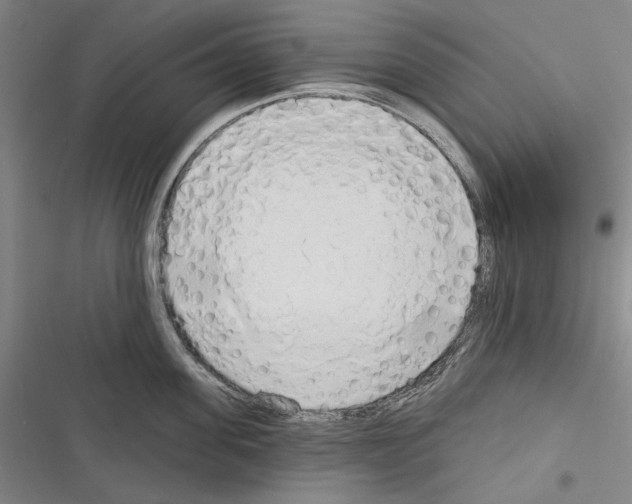 X0000116320955201001131001