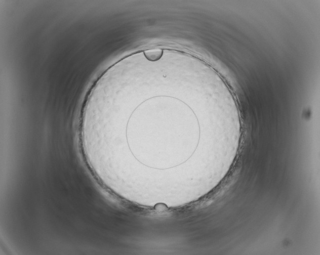 X0000116321525201001130953