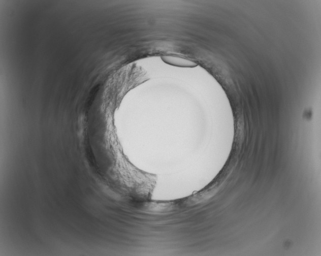 X0000116330135201001131032