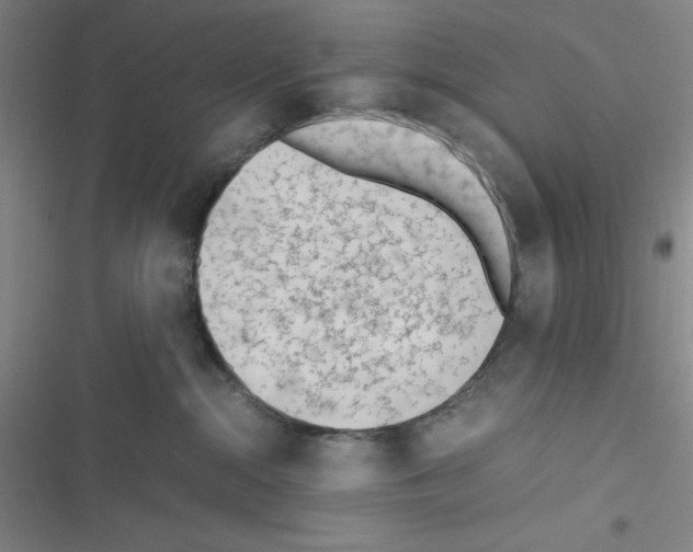 X0000116330284201001131031