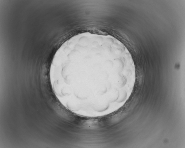 X0000116330366201001131029