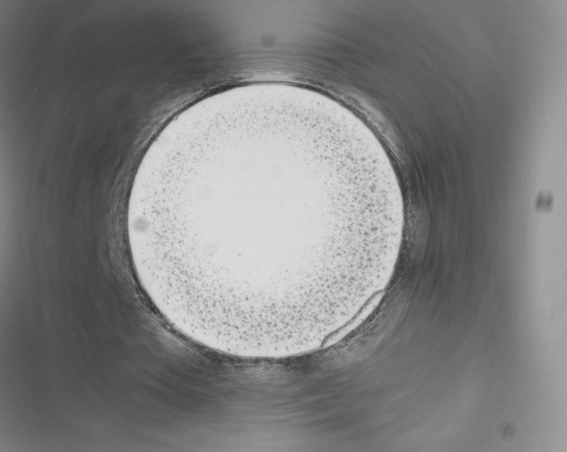 X0000116330385201001131029