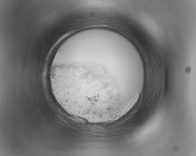 X0000116330387201001131029