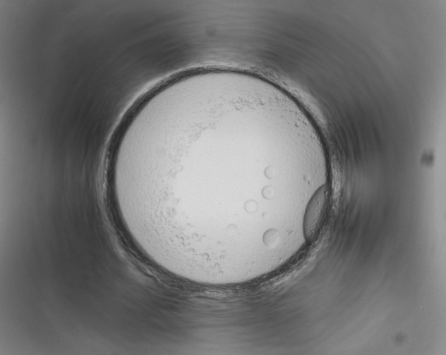 X0000116330580201001131026
