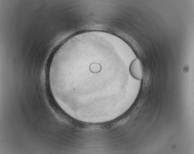 X0000116330674201001131025